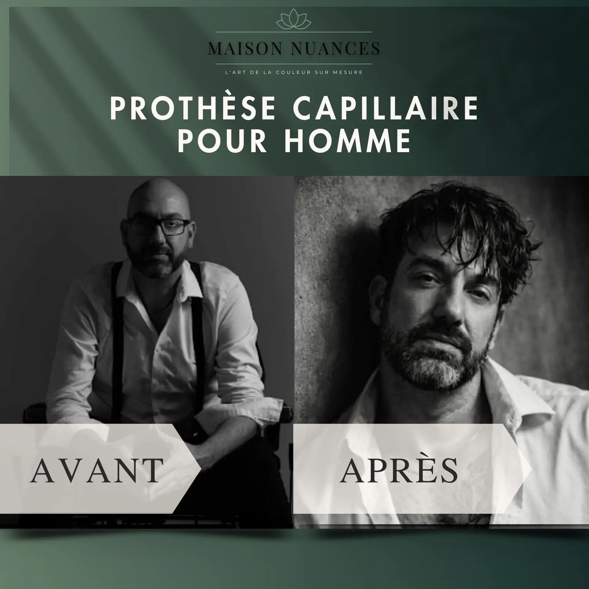 Résultat avant/après d'une prothèse capillaire pour homme à Terrebonne